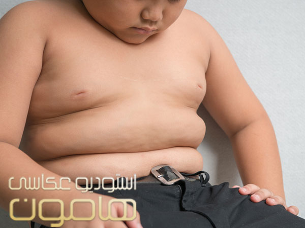 تأثیر چاقی در بلوغ زودرس