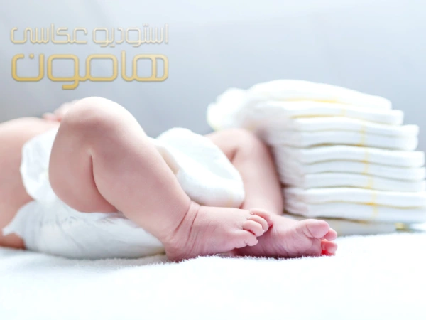 علائم حساسیت نوزاد به پوشک