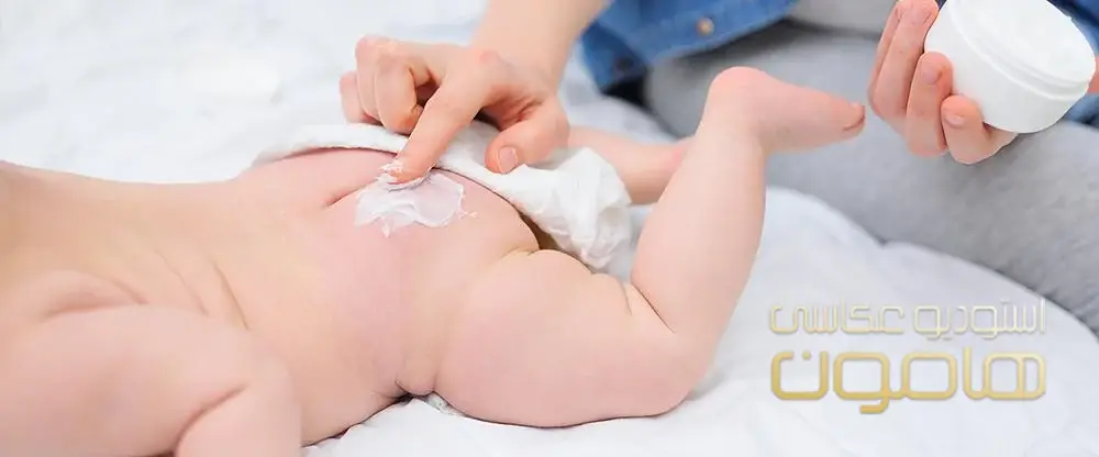 علائم حساسیت نوزاد به پوشک