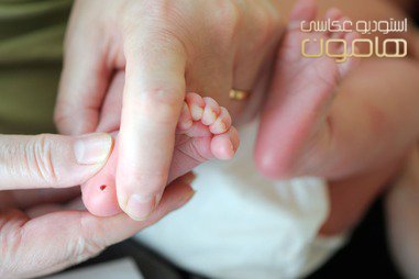 غربالگری تیروئید در نوزادان