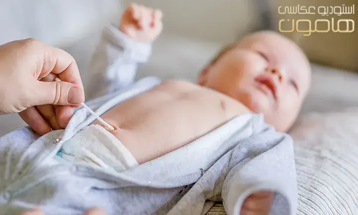 چگونه از بند ناف نوزاد مراقبت کنیم؟