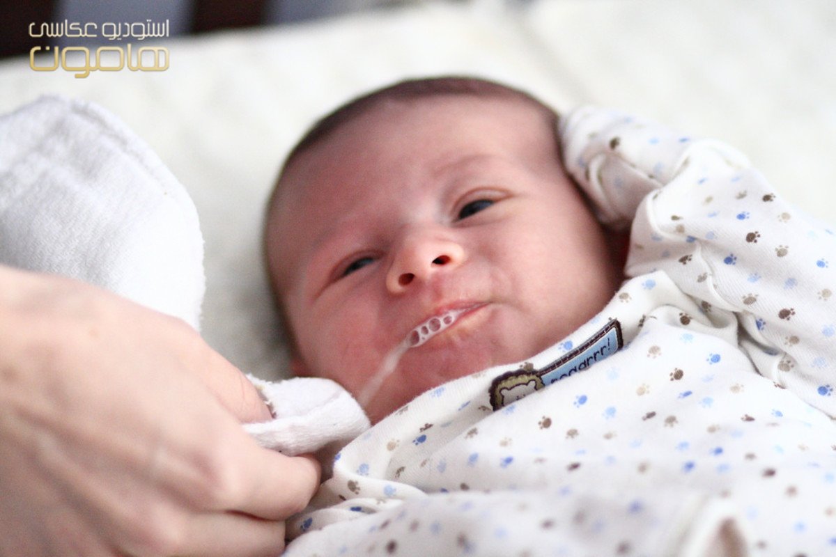 علائم و نشانه های رفلاکس در نوزادان