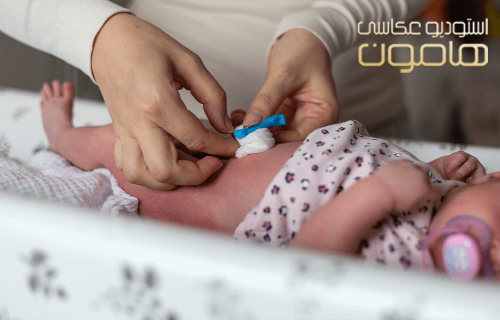 نحوه مراقبت از بند ناف نوزاد