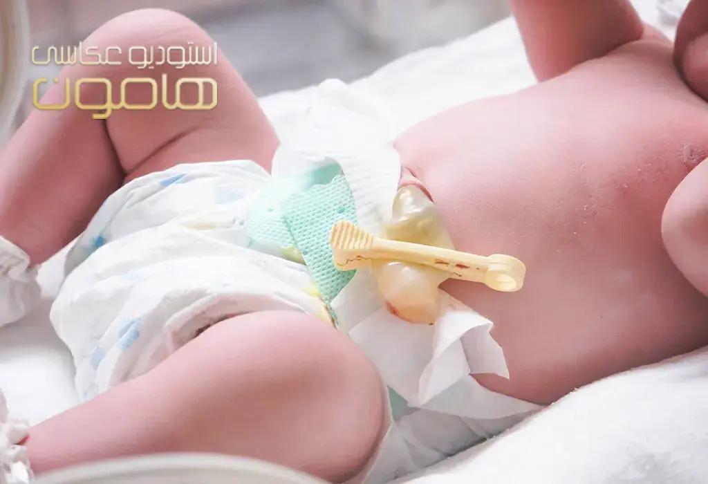 نحوه مراقبت از بند ناف نوزاد