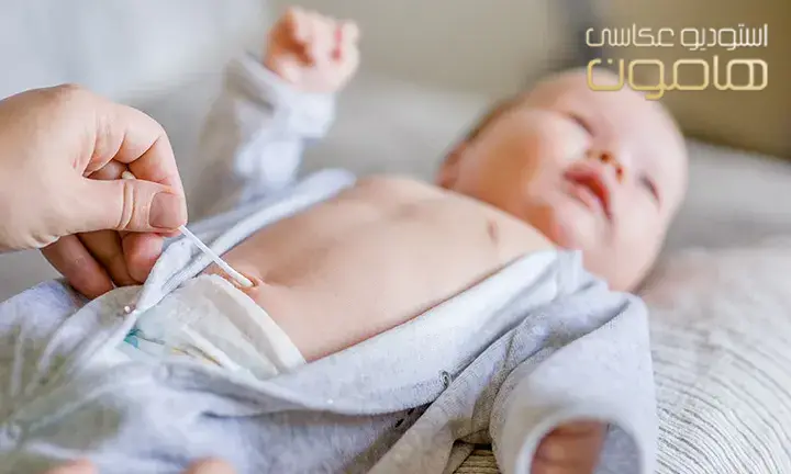 نحوه مراقبت از بند ناف نوزاد
